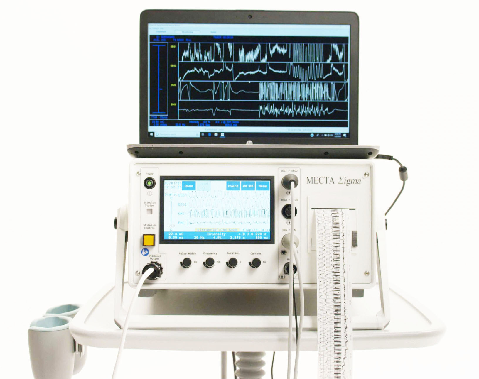 Electroshock Therapy Machine (ECT) - A-1 Medical Integration